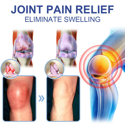 ✅ HSE Approved: Ourlyard® Magnesium Pain Healing Bone Cream (Treatment for arthritis, neuropathyy, rheumatic diseases, muscle spasms, twitches and sports injuries)