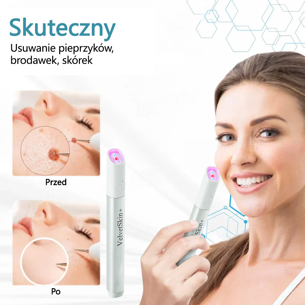 ✨✨✨ Bikenda® VelvetSkin+ – Laserowy Długopis CO₂ do Usuwania 🟤 Znamion, 🦠 Brodawek, 🔘 Przebarwień i Innych Niedoskonałości Skóry  🌿