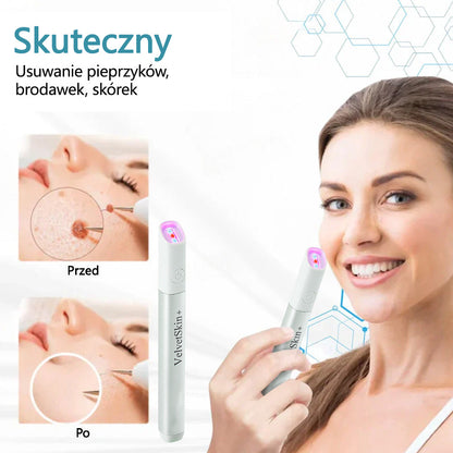 ✨✨✨ Bikenda® VelvetSkin+ – Laserowy Długopis CO₂ do Usuwania 🟤 Znamion, 🦠 Brodawek, 🔘 Przebarwień i Innych Niedoskonałości Skóry  🌿
