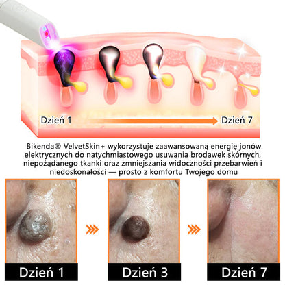 ✨✨✨ Bikenda® VelvetSkin+ – Laserowy Długopis CO₂ do Usuwania 🟤 Znamion, 🦠 Brodawek, 🔘 Przebarwień i Innych Niedoskonałości Skóry  🌿