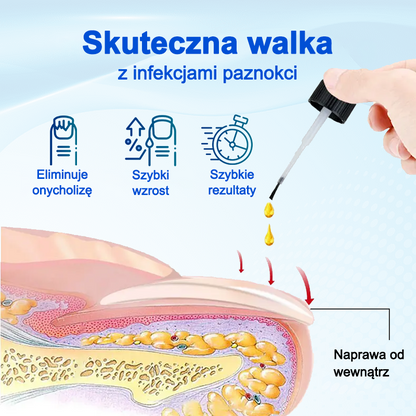 Biancat® OnyxoGuard Serum do wzrostu i naprawy paznokci🔥