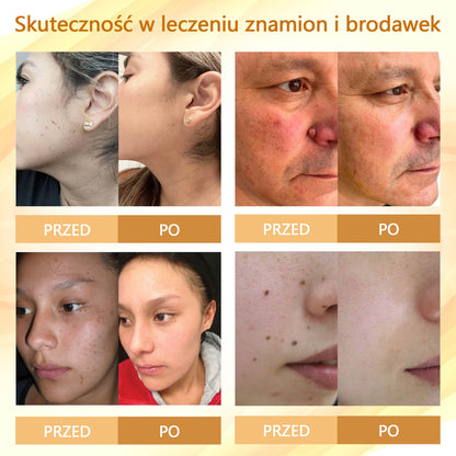 Krem regenerujący skórę Croaie® condense mellifera   ⭐️⭐️