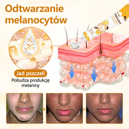 Timilk® VitiCalm krem z jadem pszczelim🌻🌻🌻