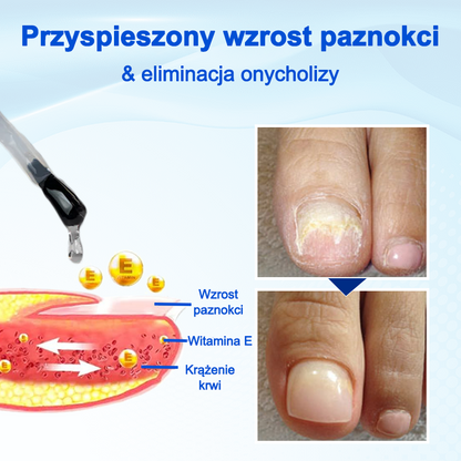 Biancat® OnyxoGuard Serum do wzrostu i naprawy paznokci🔥