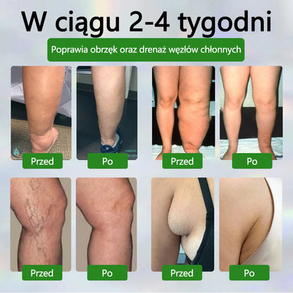 🌿🌿🌿ATTDX® Krem ziołowy łagodzący obrzęki z czarnuszką