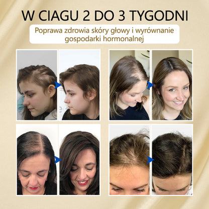 Timilk® VitaStrand Biotin Hair Growth Spray✅ ✅Gęste, lśniące włosy w zaledwie kilka tygodni