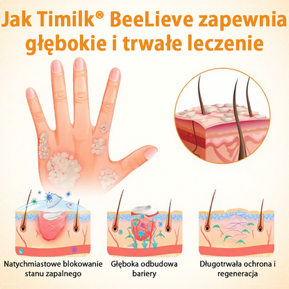Timilk® BeeLieve Łuszczyca Pielęgnacja skóry🌿🌿🌿
