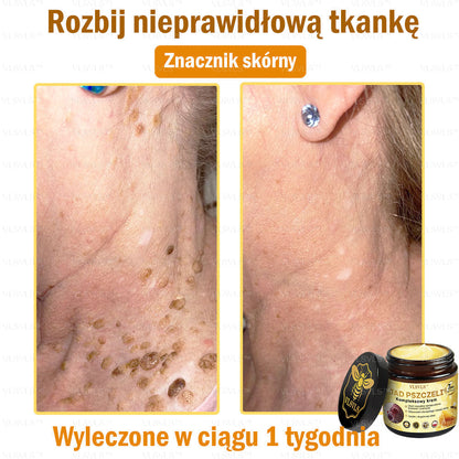 VLSVLS™ Krem Komprehensywny z Jadami Pszczół 🇵🇱 Rekomendowany przez Dermatologów