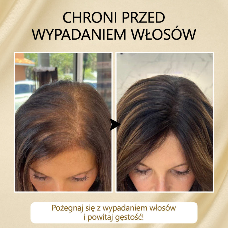 Timilk® VitaStrand Biotin Hair Growth Spray✅ ✅Gęste, lśniące włosy w zaledwie kilka tygodni