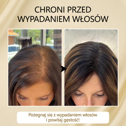 Timilk® VitaStrand Biotin Hair Growth Spray✅ ✅Gęste, lśniące włosy w zaledwie kilka tygodni