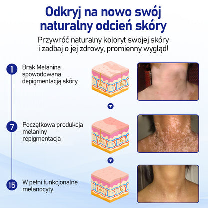⭐⭐⭐⭐Timilk® VitiClear Spray ziołowy