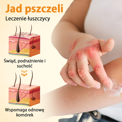Timilk® BeeLieve Łuszczyca Pielęgnacja skóry🌿🌿🌿