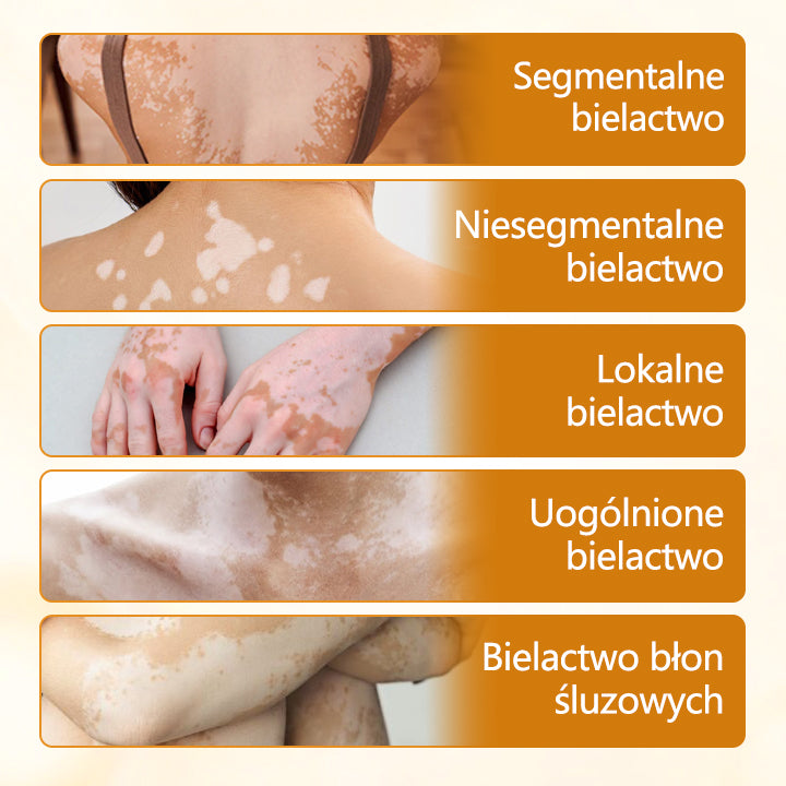Timilk® VitiCalm krem z jadem pszczelim🌻🌻🌻