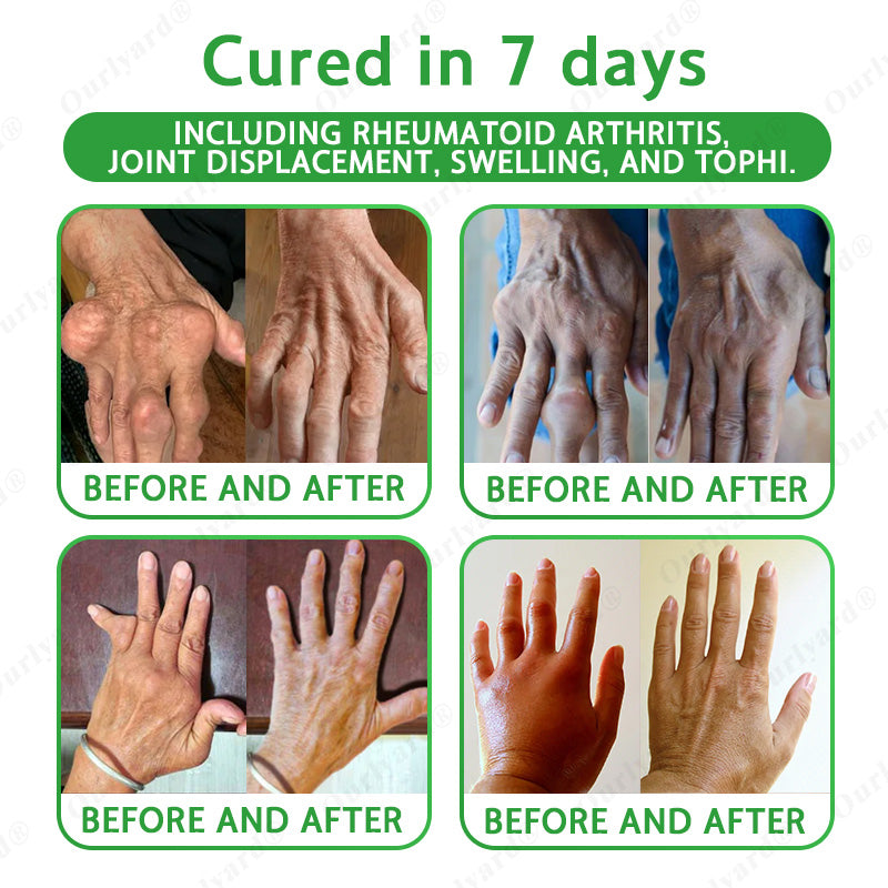 👨‍⚕️✅Ourlyard® Advanced Magnesium & Emu Oil Massage Pain Relief Cream (🏅The Ultimate Solution for Muscle Aches, Arthritis, Joint Pain, Nerve Pain, Inflammation, and Stiffness) – Made in the USA