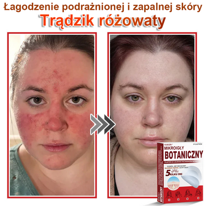 KUBOZN® Mikroigłowy botaniczny środek do usuwania narośli skórnych ✅✅✅✅wyprodukowano w Polsce