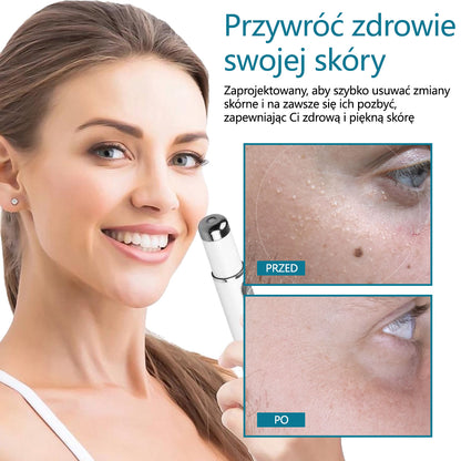 ✅✅Pióro laserowe do usuwania moli i brodawek Bikenda® LumeSkin