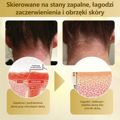 Krem regenerujący skórę Croaie® condense mellifera   ⭐️⭐️
