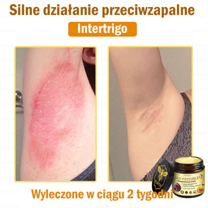 VLSVLS™ Krem Komprehensywny z Jadami Pszczół 🇵🇱 Rekomendowany przez Dermatologów