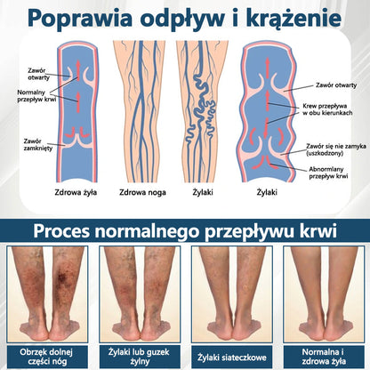 Detoksykujący krem ziołowy z czarnym kminkiem Cvreoz®🩹