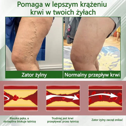 🌿🌿🌿ATTDX® Krem ziołowy łagodzący obrzęki z czarnuszką