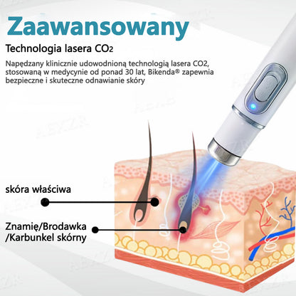 Bikenda® NOWOŚĆ Nieinwazyjny laser do usuwania pieprzyków i brodawek🔥🔥🔥