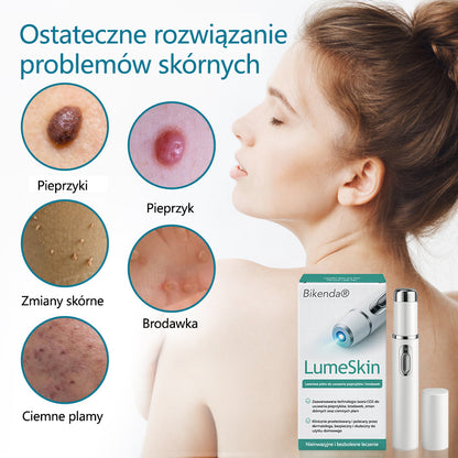 ✅✅Pióro laserowe do usuwania moli i brodawek Bikenda® LumeSkin