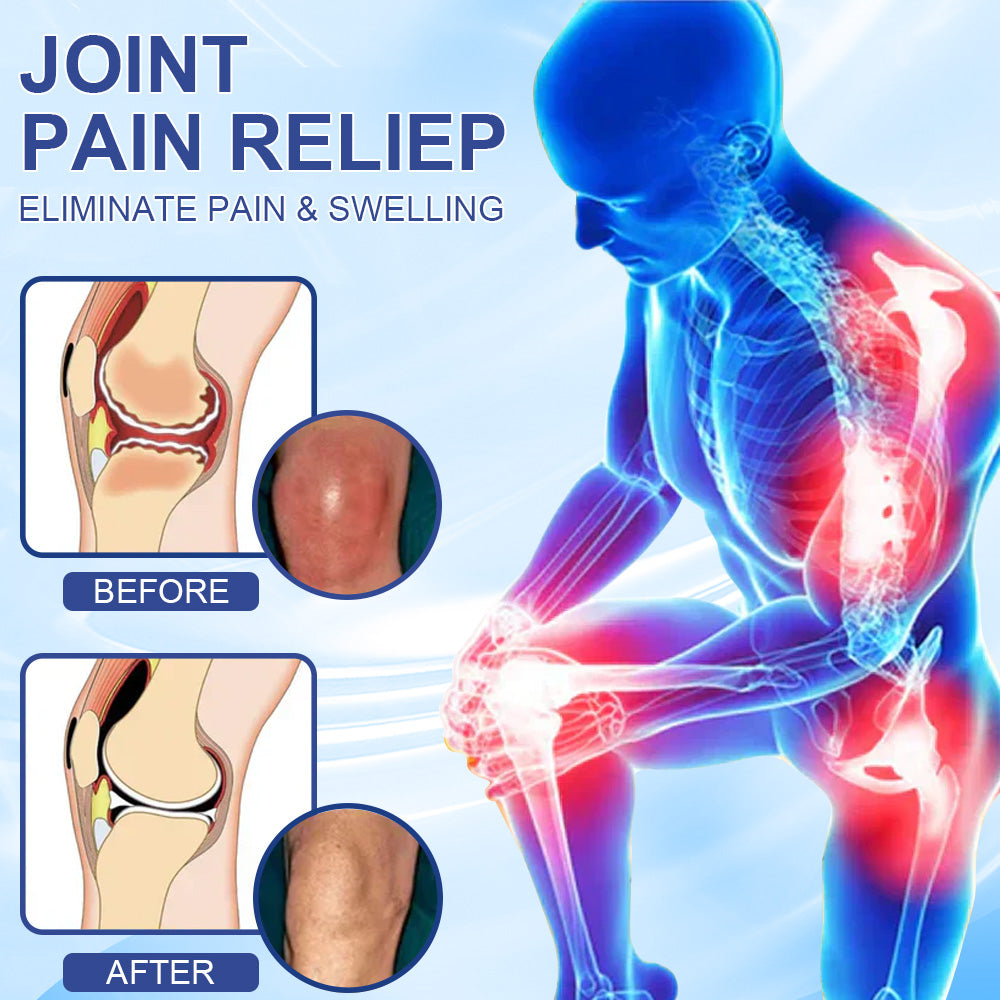 ✅ HSE Approved: Ourlyard® Magnesium Pain Healing Bone Cream (Treatment for arthritis, neuropathyy, rheumatic diseases, muscle spasms, twitches and sports injuries)